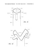 CLIP-BASED SYSTEMS AND METHODS FOR TREATING SEPTAL DEFECTS diagram and image