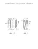 CLIP-BASED SYSTEMS AND METHODS FOR TREATING SEPTAL DEFECTS diagram and image