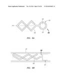 CLIP-BASED SYSTEMS AND METHODS FOR TREATING SEPTAL DEFECTS diagram and image