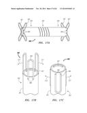 CLIP-BASED SYSTEMS AND METHODS FOR TREATING SEPTAL DEFECTS diagram and image