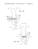 CLIP-BASED SYSTEMS AND METHODS FOR TREATING SEPTAL DEFECTS diagram and image