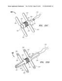 CLIP-BASED SYSTEMS AND METHODS FOR TREATING SEPTAL DEFECTS diagram and image