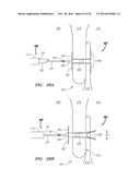 CLIP-BASED SYSTEMS AND METHODS FOR TREATING SEPTAL DEFECTS diagram and image