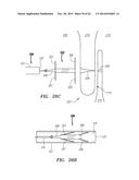 CLIP-BASED SYSTEMS AND METHODS FOR TREATING SEPTAL DEFECTS diagram and image