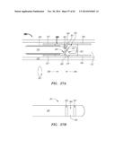 CLIP-BASED SYSTEMS AND METHODS FOR TREATING SEPTAL DEFECTS diagram and image