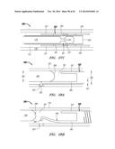 CLIP-BASED SYSTEMS AND METHODS FOR TREATING SEPTAL DEFECTS diagram and image