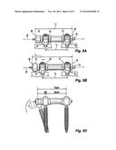 Flexible Spine Stabilization System diagram and image