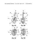 Flexible Spine Stabilization System diagram and image