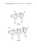 Flexible Spine Stabilization System diagram and image