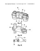 Flexible Spine Stabilization System diagram and image