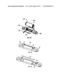 Flexible Spine Stabilization System diagram and image