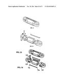 Flexible Spine Stabilization System diagram and image