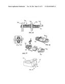 Flexible Spine Stabilization System diagram and image