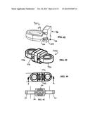 Flexible Spine Stabilization System diagram and image