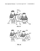 Flexible Spine Stabilization System diagram and image