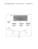 DENTAL OCCLUSION AND TENSION BAND TIES, SYSTEMS AND METHODS diagram and image