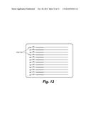 DENTAL OCCLUSION AND TENSION BAND TIES, SYSTEMS AND METHODS diagram and image