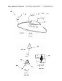 DENTAL OCCLUSION AND TENSION BAND TIES, SYSTEMS AND METHODS diagram and image