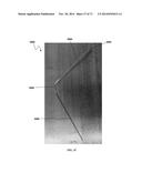 DENTAL OCCLUSION AND TENSION BAND TIES, SYSTEMS AND METHODS diagram and image