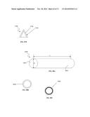 DENTAL OCCLUSION AND TENSION BAND TIES, SYSTEMS AND METHODS diagram and image