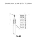 DENTAL OCCLUSION AND TENSION BAND TIES, SYSTEMS AND METHODS diagram and image