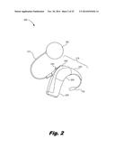 RETENTION OF A MAGNET IN A COCHLEAR IMPLANT diagram and image