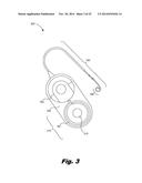 RETENTION OF A MAGNET IN A COCHLEAR IMPLANT diagram and image