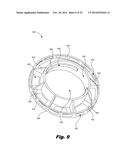 RETENTION OF A MAGNET IN A COCHLEAR IMPLANT diagram and image