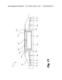 RETENTION OF A MAGNET IN A COCHLEAR IMPLANT diagram and image