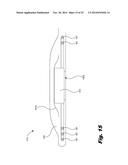 RETENTION OF A MAGNET IN A COCHLEAR IMPLANT diagram and image