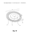 RETENTION OF A MAGNET IN A COCHLEAR IMPLANT diagram and image