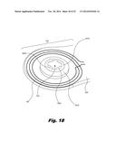 RETENTION OF A MAGNET IN A COCHLEAR IMPLANT diagram and image