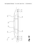 RETENTION OF A MAGNET IN A COCHLEAR IMPLANT diagram and image