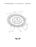 RETENTION OF A MAGNET IN A COCHLEAR IMPLANT diagram and image