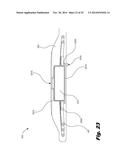 RETENTION OF A MAGNET IN A COCHLEAR IMPLANT diagram and image