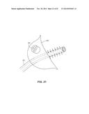 METHODS AND DEVICES FOR NON-INVASIVE CEREBRAL AND SYSTEMIC COOLING diagram and image