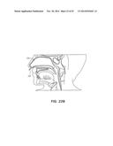 METHODS AND DEVICES FOR NON-INVASIVE CEREBRAL AND SYSTEMIC COOLING diagram and image