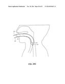 METHODS AND DEVICES FOR NON-INVASIVE CEREBRAL AND SYSTEMIC COOLING diagram and image