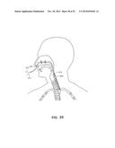 METHODS AND DEVICES FOR NON-INVASIVE CEREBRAL AND SYSTEMIC COOLING diagram and image