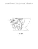 METHODS AND DEVICES FOR NON-INVASIVE CEREBRAL AND SYSTEMIC COOLING diagram and image