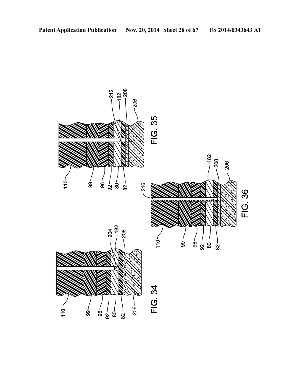IMPLANTABLE ELECTRODE ARRAY ASSEMBLY INCLUDING A CARRIER WITH EMBEDDED     CONTROL MODULES CONTAINED IN PACKAGES, THE PACKAGES EXTENDING OUTWARDLY     SO AS TO EXTEND OVER THE CARRIER - diagram, schematic, and image 29