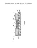 IMPLANTABLE ELECTRODE ARRAY ASSEMBLY INCLUDING A CARRIER WITH EMBEDDED     CONTROL MODULES CONTAINED IN PACKAGES, THE PACKAGES EXTENDING OUTWARDLY     SO AS TO EXTEND OVER THE CARRIER diagram and image