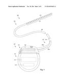 ELECTRICAL STIMULATION LEADS AND SYSTEMS WITH ANCHORING UNITS AND METHODS     OF MAKING AND USING diagram and image