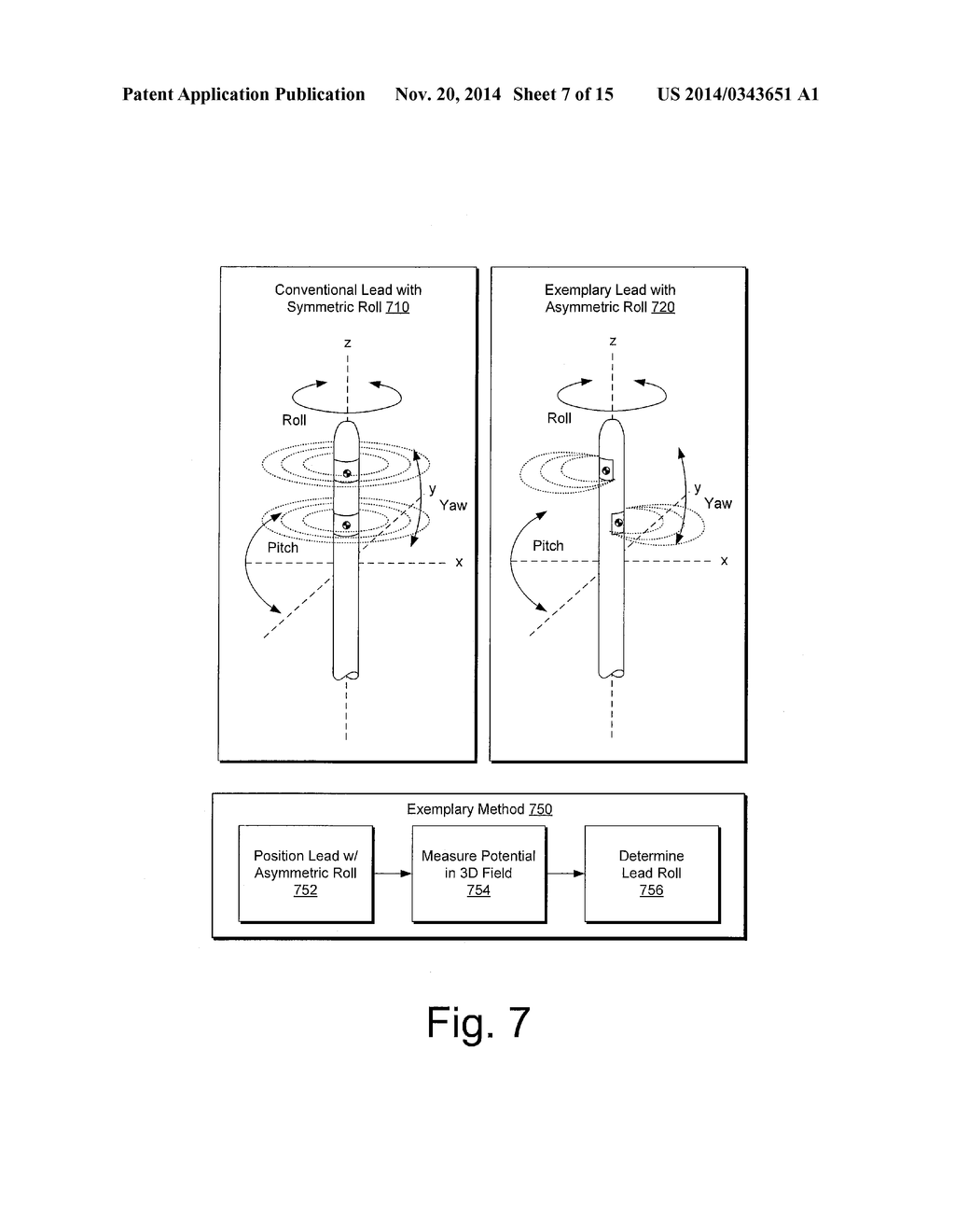 METHOD TO ENHANCE ELECTRODE LOCALIZATION OF A LEAD - diagram, schematic, and image 08