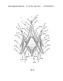 STENT FOR THE POSITIONING AND ANCHORING OF A VALVULAR PROSTHESIS IN AN     IMPLANTATION SITE IN THE HEART OF A PATIENT diagram and image