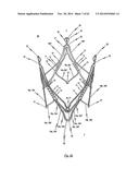 STENT FOR THE POSITIONING AND ANCHORING OF A VALVULAR PROSTHESIS IN AN     IMPLANTATION SITE IN THE HEART OF A PATIENT diagram and image