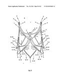 STENT FOR THE POSITIONING AND ANCHORING OF A VALVULAR PROSTHESIS IN AN     IMPLANTATION SITE IN THE HEART OF A PATIENT diagram and image