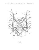 STENT FOR THE POSITIONING AND ANCHORING OF A VALVULAR PROSTHESIS IN AN     IMPLANTATION SITE IN THE HEART OF A PATIENT diagram and image