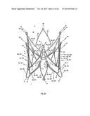 STENT FOR THE POSITIONING AND ANCHORING OF A VALVULAR PROSTHESIS IN AN     IMPLANTATION SITE IN THE HEART OF A PATIENT diagram and image