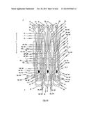 STENT FOR THE POSITIONING AND ANCHORING OF A VALVULAR PROSTHESIS IN AN     IMPLANTATION SITE IN THE HEART OF A PATIENT diagram and image